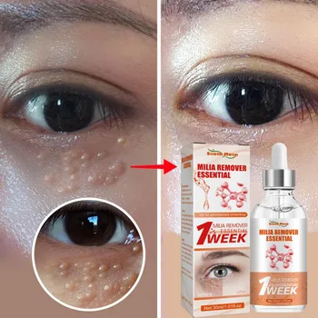 Efektívne Odstraňuje Tuk Granule Oči Cream Zlepšiť Oko Taška Jemné Linky Hydratačné Anti-Opuchy Zdvíhacie Spevňujúce Sérum Na Starostlivosť O Oči